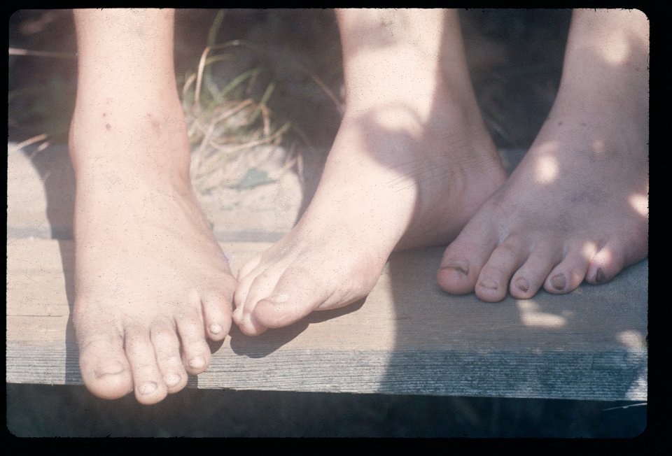 Feet 1972